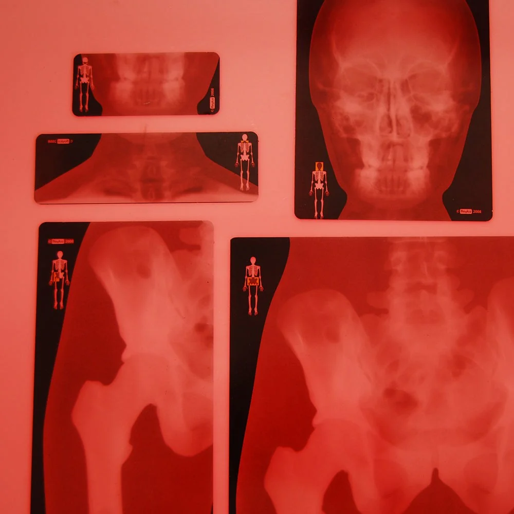 Human X-rays - Image 3