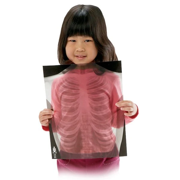 Human X-rays - Image 4