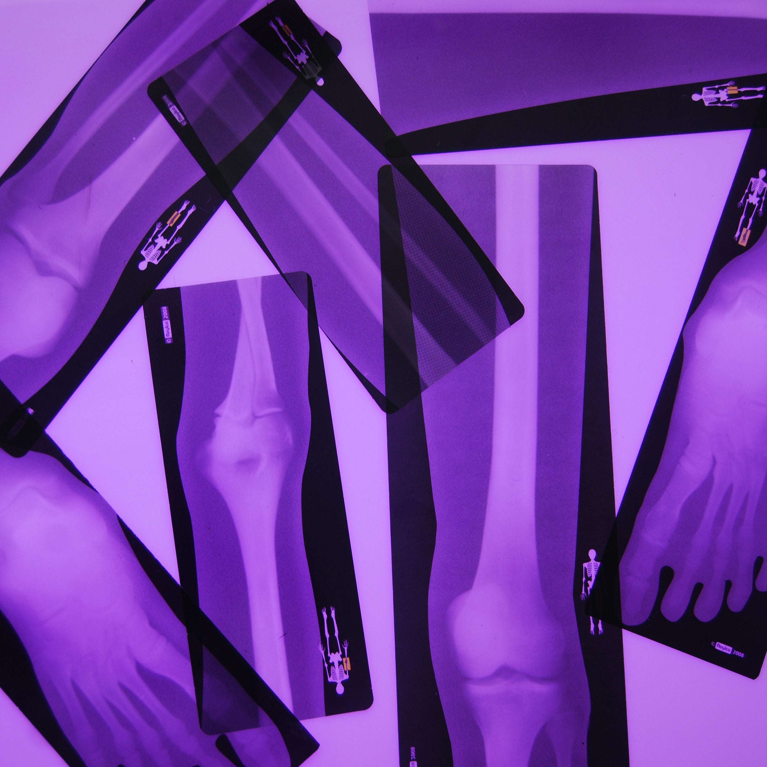 Human X-rays - Image 5