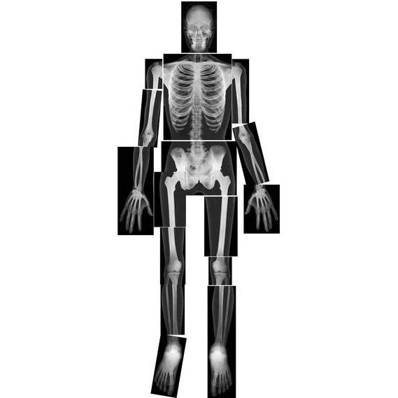 Human X-rays - Image 6